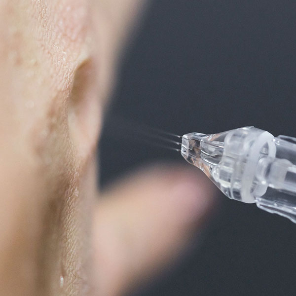 Soin Médical Jet® : micro-jet d’acide hyaluronique projeté sur la peau, sans aiguille